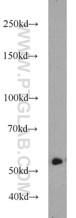 GFP tag Antibody in Western Blot (WB)