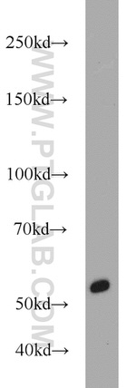 GFP tag Antibody in Western Blot (WB)