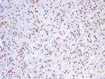 SMARCAL1 Monoclonal Antibody (PCRP-SMARCAL1-1C4)