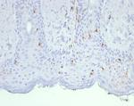 Langerin/CD207 (Marker of Langerhans Cells) Monoclonal Antibody (LGRN/7430)