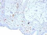 Langerin/CD207 (Marker of Langerhans Cells) Monoclonal Antibody (LGRN/7356)