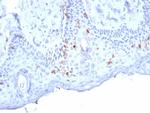Langerin/CD207 (Marker of Langerhans Cells) Monoclonal Antibody (LGRN/7357)