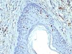 Langerin/CD207 (Marker of Langerhans Cells) Antibody in Immunohistochemistry (Paraffin) (IHC (P))
