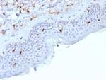 Langerin/CD207 (Marker of Langerhans Cells) Antibody in Immunohistochemistry (Paraffin) (IHC (P))
