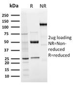 Langerin/CD207 (Marker of Langerhans Cells) Recombinant Rabbit Monoclonal Antibody (LGRN/3136R)