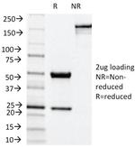 NOX4/NADPH Oxidase 4 Monoclonal Antibody (NOX4, 1245)