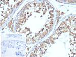 Plasminogen Activator Inhibitor (Type 1)/PAI-1 (Breast Cancer Prognostic Marker) Recombinant Mouse Monoclonal Antibody (rTJA6)