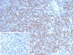 NEUROG3/Neurogenin 3/NGN3 (Transcription Factor) Monoclonal Antibody (NGN3/1808)