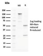 PAPP-A/Pappalysin-1 Antibody in SDS-PAGE (SDS-PAGE)