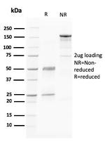 PAPP-A/Pappalysin-1 (Marker of Atherosclerosis and Aneuploid Fetus) Antibody in SDS-PAGE (SDS-PAGE)