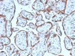 PAPP-A/Pappalysin-1 (Marker of Atherosclerosis and Aneuploid Fetus) Monoclonal Antibody (PAPPA/2717)