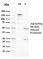 PAPP-A/Pappalysin-1 (Marker of Atherosclerosis and Aneuploid Fetus) Antibody in SDS-PAGE (SDS-PAGE)