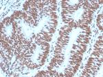 PAX2 (Renal Cell and Ovarian Carcinoma Marker) Antibody in Immunohistochemistry (Paraffin) (IHC (P))