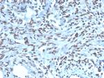 PAX2 (Renal Cell and Ovarian Carcinoma Marker) Monoclonal Antibody (PAX2/1104)