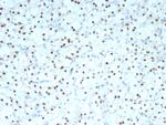 PAX2 (Renal Cell and Ovarian Carcinoma Marker) Recombinant Rabbit Monoclonal Antibody (PAX2/8671R)