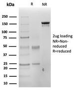 PAX3 Monoclonal Antibody (PAX3/4700)