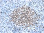 PAX5/BSAP (Early B-Cell Marker) Antibody in Immunohistochemistry (Paraffin) (IHC (P))