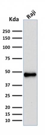 PAX5/BSAP (Early B-Cell Marker) Monoclonal Antibody (rPAX5/2060)