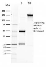 PAX5/BSAP (Early B-Cell Marker) Antibody in SDS-PAGE (SDS-PAGE)