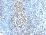 PAX5/BSAP (Early B-Cell Marker) Antibody in Immunohistochemistry (Paraffin) (IHC (P))