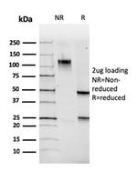 PAX5/BSAP (Early B-Cell Marker) Antibody in SDS-PAGE (SDS-PAGE)