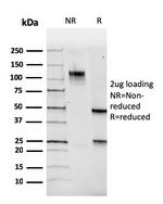 PAX5/BSAP Antibody in SDS-PAGE (SDS-PAGE)