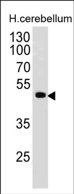 PAX6 Monoclonal Antibody (PAX6, 498)