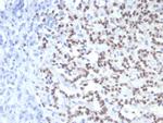 PAX6 (Stem Cell Marker) Monoclonal Antibody (PAX6/7710)