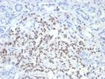 PAX6 (Stem Cell Marker) Monoclonal Antibody (PAX6/7705)