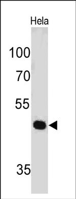 PAX7 Monoclonal Antibody (PAX7, 497)