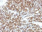 PAX7 (Rhabdomyosarcoma Marker) Monoclonal Antibody (SPM613)