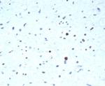 PAX7 (Rhabdomyosarcoma Marker) Recombinant Rabbit Monoclonal Antibody (PAX7/7079R)