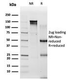PBX2/PRL (Transcription Factor) Antibody in SDS-PAGE (SDS-PAGE)