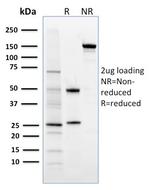 FOXP3 (Forkhead Box Protein P3)/Scurfin Antibody in SDS-PAGE (SDS-PAGE)
