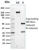 FOXP3 (Forkhead Box Protein P3)/Scurfin Antibody in SDS-PAGE (SDS-PAGE)