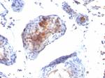 FOXP3 (Forkhead Box Protein P3)/Scurfin Antibody in Immunohistochemistry (Paraffin) (IHC (P))