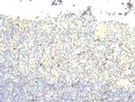 FOXP3 (Forkhead Box Protein P3)/Scurfin Antibody in Immunohistochemistry (Paraffin) (IHC (P))