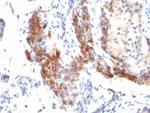 FOXP3 (Forkhead Box Protein P3)/Scurfin Antibody in Immunohistochemistry (Paraffin) (IHC (P))