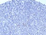 FOXP3 (Forkhead Box Protein P3)/Scurfin Antibody in Immunohistochemistry (Paraffin) (IHC (P))