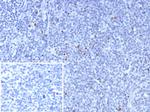 FOXP3 (Forkhead Box Protein P3)/Scurfin Antibody in Immunohistochemistry (Paraffin) (IHC (P))