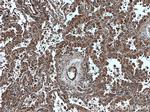 DUSP22 Antibody in Immunohistochemistry (Paraffin) (IHC (P))