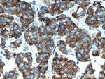 PTRH2 Antibody in Immunohistochemistry (Paraffin) (IHC (P))