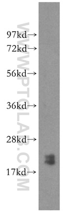 PTRH2 Antibody in Western Blot (WB)