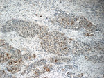BRD7 Antibody in Immunohistochemistry (Paraffin) (IHC (P))