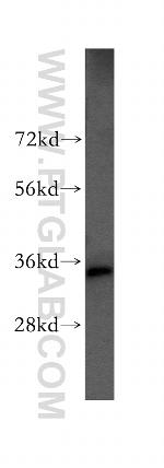 RPLP0 Antibody in Western Blot (WB)
