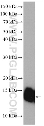 SEC61B Antibody in Western Blot (WB)