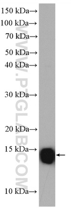 SEC61B Antibody in Western Blot (WB)