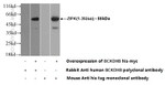 Phospho-ZIPK (Ser311) Antibody in Western Blot (WB)
