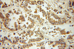 Phospho-ZIPK (Ser311) Antibody in Immunohistochemistry (Paraffin) (IHC (P))