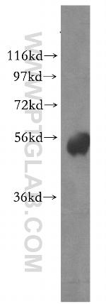 Phospho-ZIPK (Ser311) Antibody in Western Blot (WB)